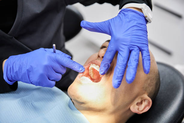 Best Emergency Dentist for Knocked-Out Tooth in Plainsboro Center, NJ