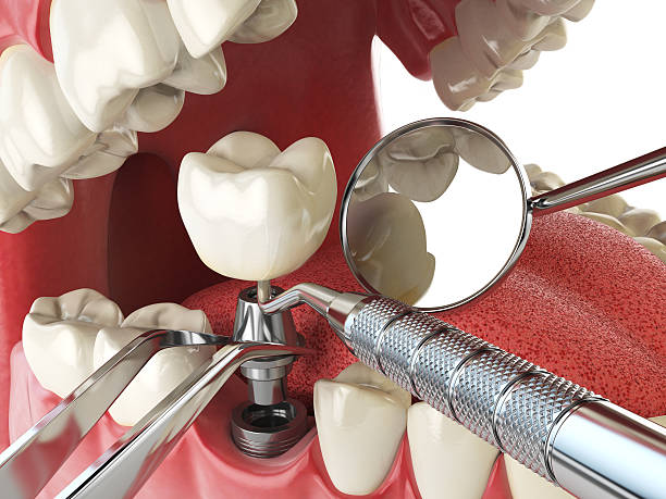 Best Emergency Dental Services for Seniors in Plainsboro Center, NJ